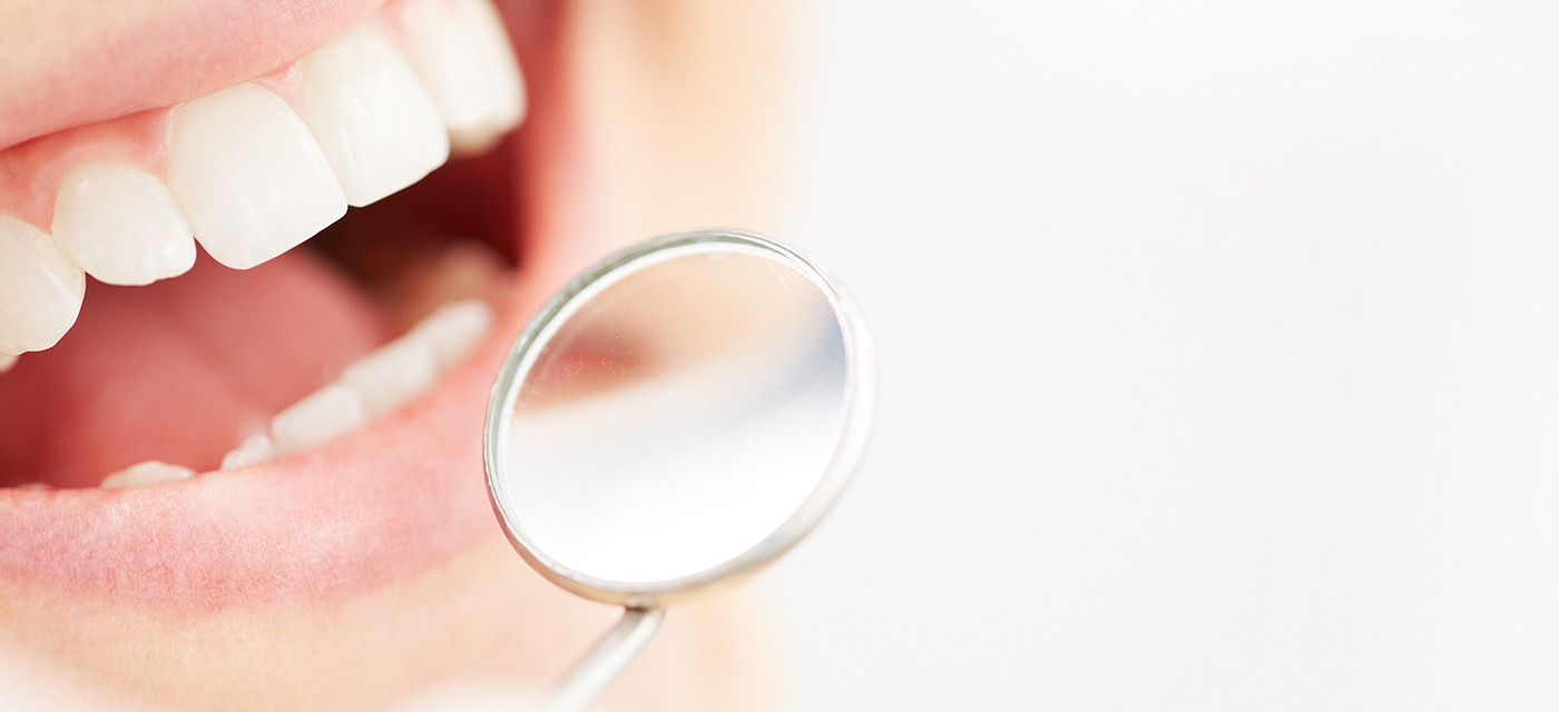 Sonrisa dental en revisión con un espejo