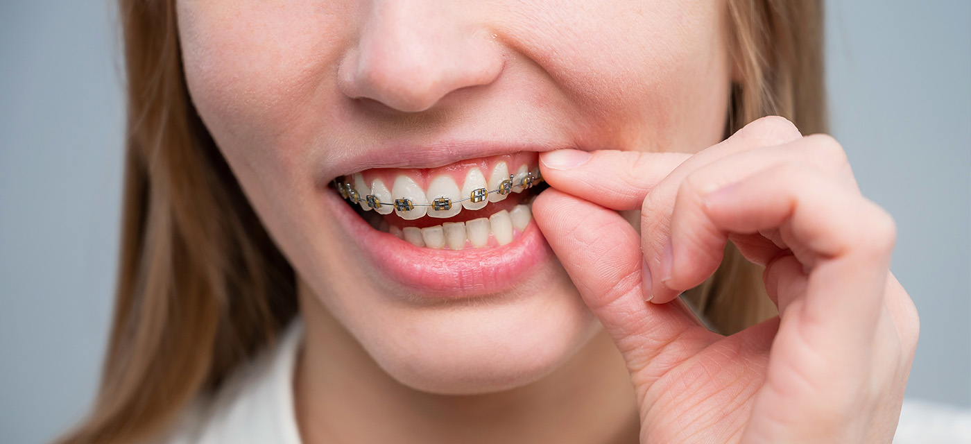 Mujer sonriendo con contorneado dental 
