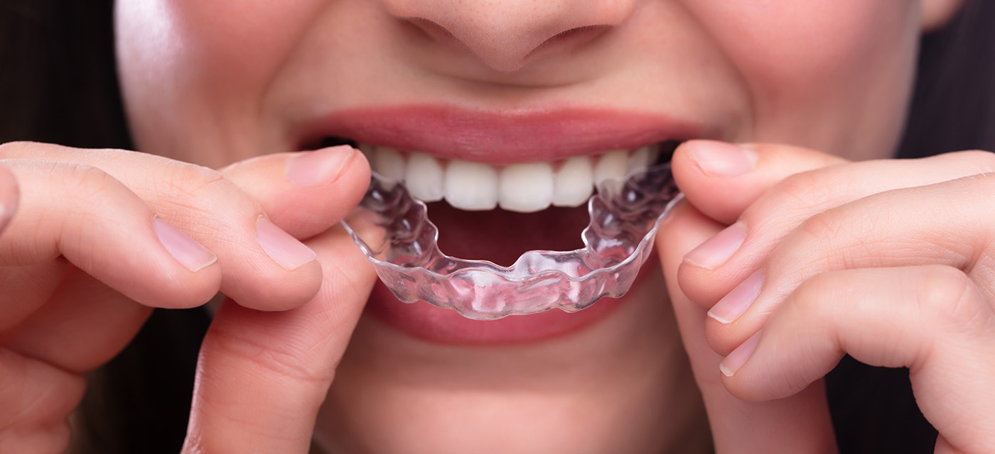 Paciente luce su sonrisa con ortodoncia invisible