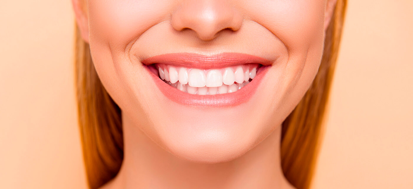 paciente con blanqueamiento dental