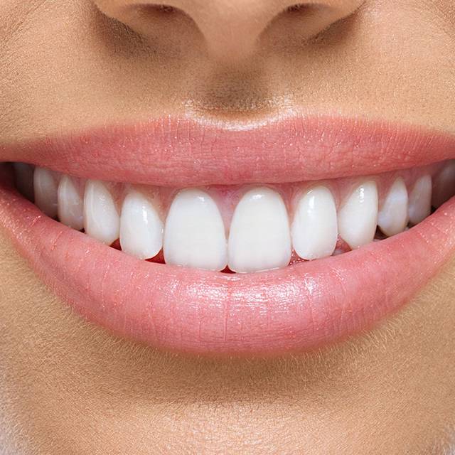 resinas y amalgamas dentales