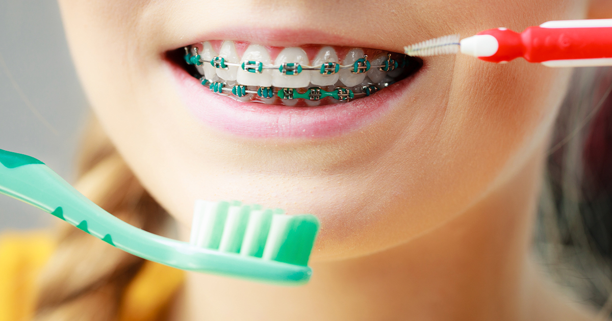 Mujer sonriendo con ortodoncia
