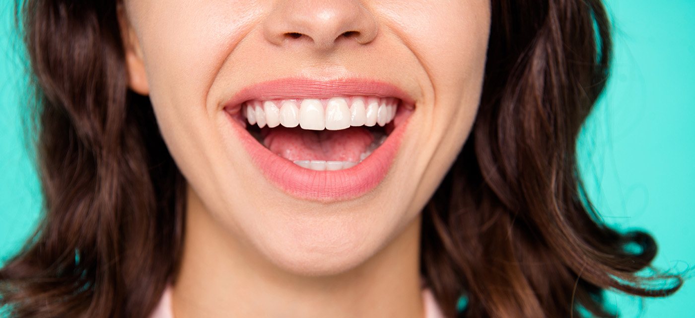 mujer con blanqueamiento dental