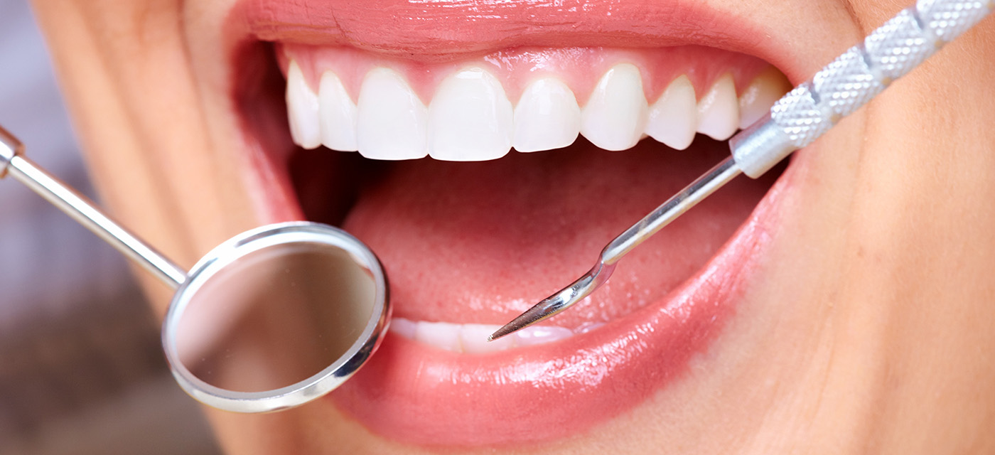 Mujer con procedimiento de gingivectomía 