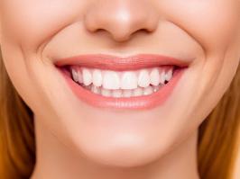 Mujer enseñando su sonrisa dental
