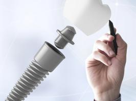 Consultorio odontológico Dentix para procesos dentales como la Endodoncia