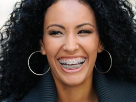 mujer morena con ortodoncia tradicional sonriendo