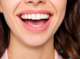 mujer tratada por periodontitis