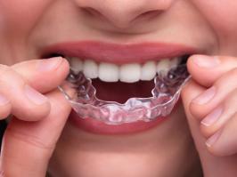 Paciente luce su sonrisa con ortodoncia invisible