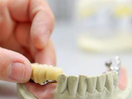 puentes dentales