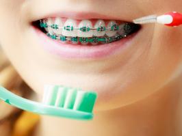 Mujer sonriendo con ortodoncia