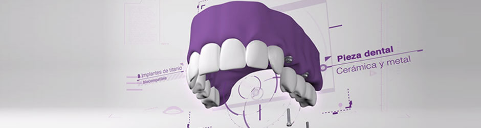Vídeo prótesis dental
