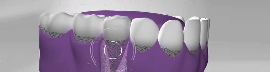 Vídeo periodoncia Vídeo periodoncia
