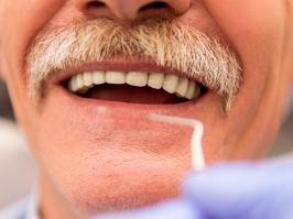 hombre con implantes dentales