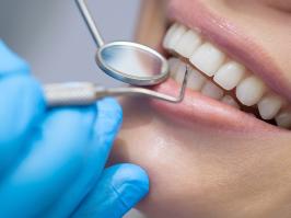 Mujer realizándose blanqueamiento dental