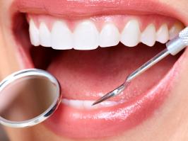 Mujer con procedimiento de gingivectomía 
