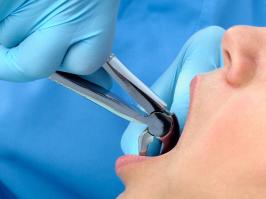 mujer en el dentista en extracción dental