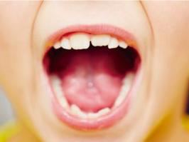 Niño con dientes de leche