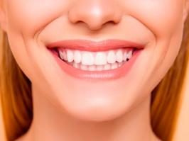 paciente con blanqueamiento dental