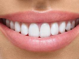 resinas y amalgamas dentales