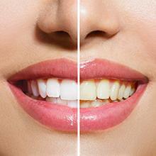 Especialistas en estética dental