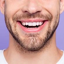 Estética dental