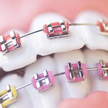 Especialistas en Ortodoncia